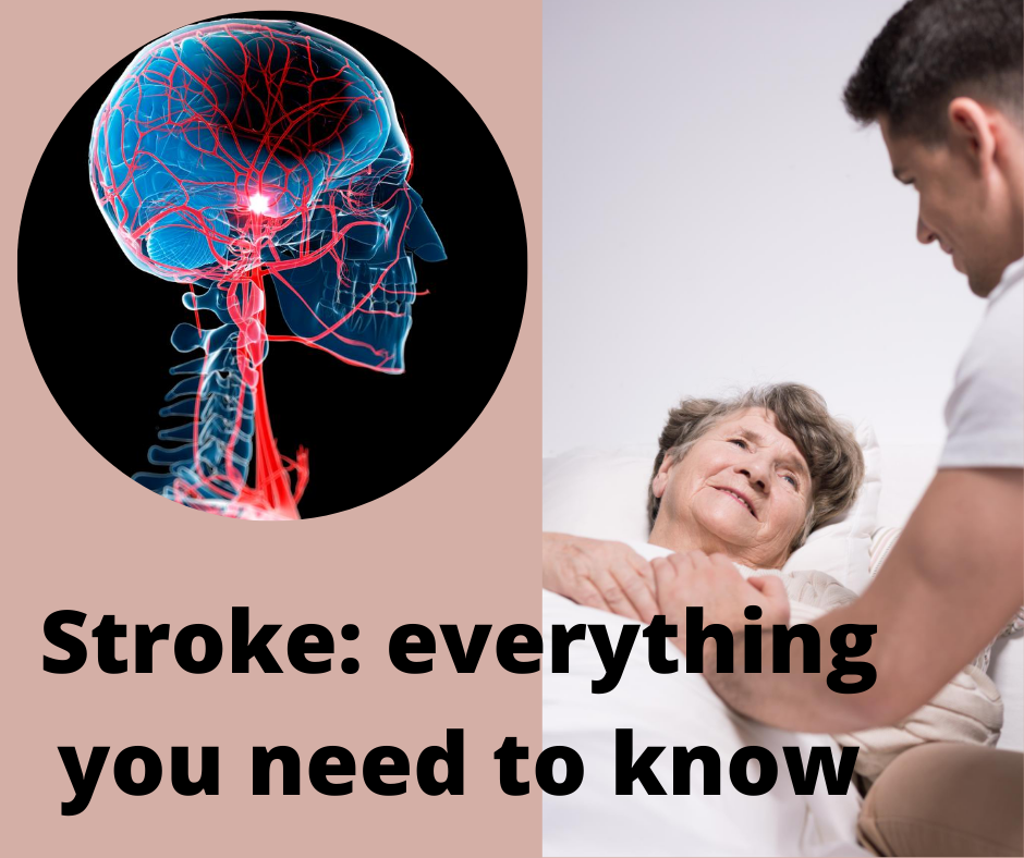 Stroke: everything you need to know 