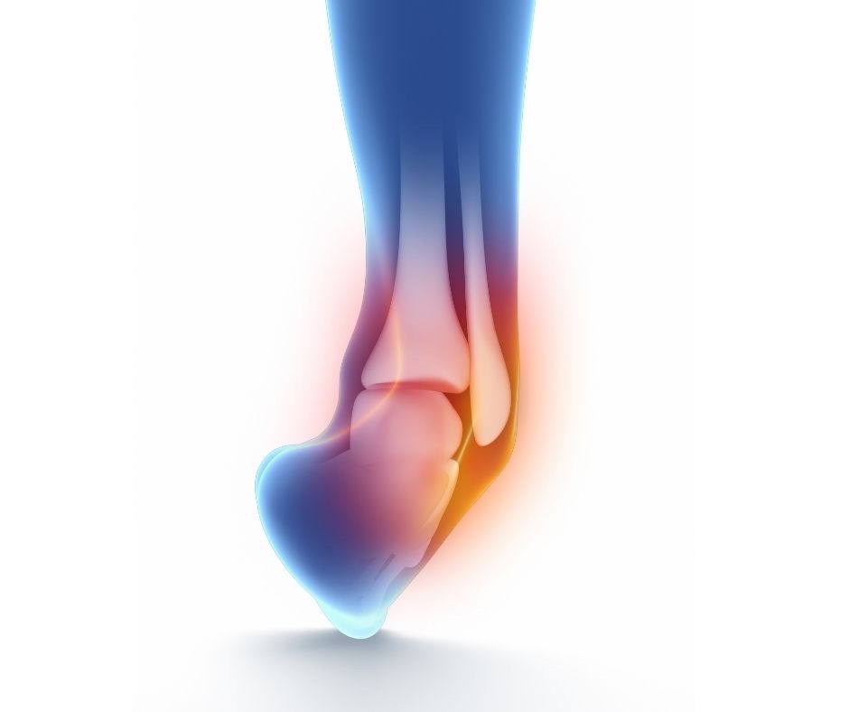 Ankle Rolling Inwards