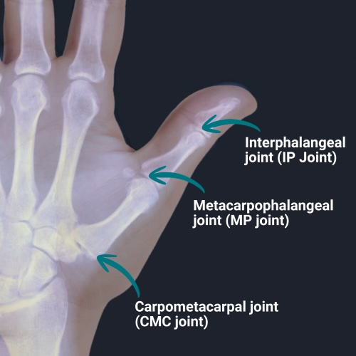 Hand with cmc joint and mp joiny